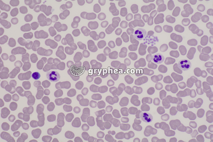 Sang humain avec plaquettes sanguines x200 - gryphea.org